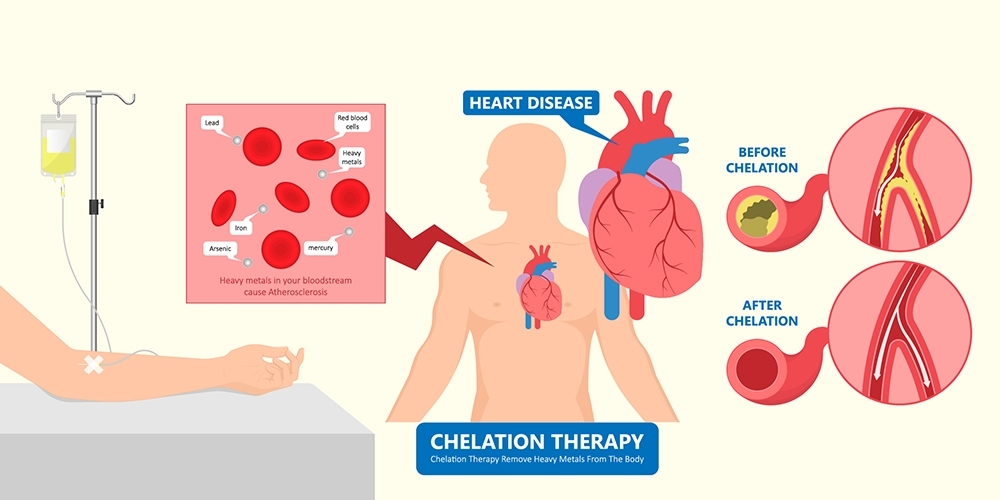 LINE_ALBUM_CHELATION THERAPY_๒๑๑๒๐๓_1